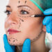 Close-up Of A Surgeon Drawing Perforation Lines On Young Woman's Face For Plastic Surgery facelift surgery