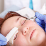 What Is Blepharoplasty? Surgeon applies a bandage to the female patient's eyelids after a blepharoplasty operation